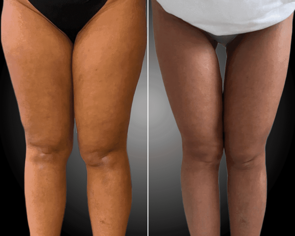 png_20230525_104719_0000