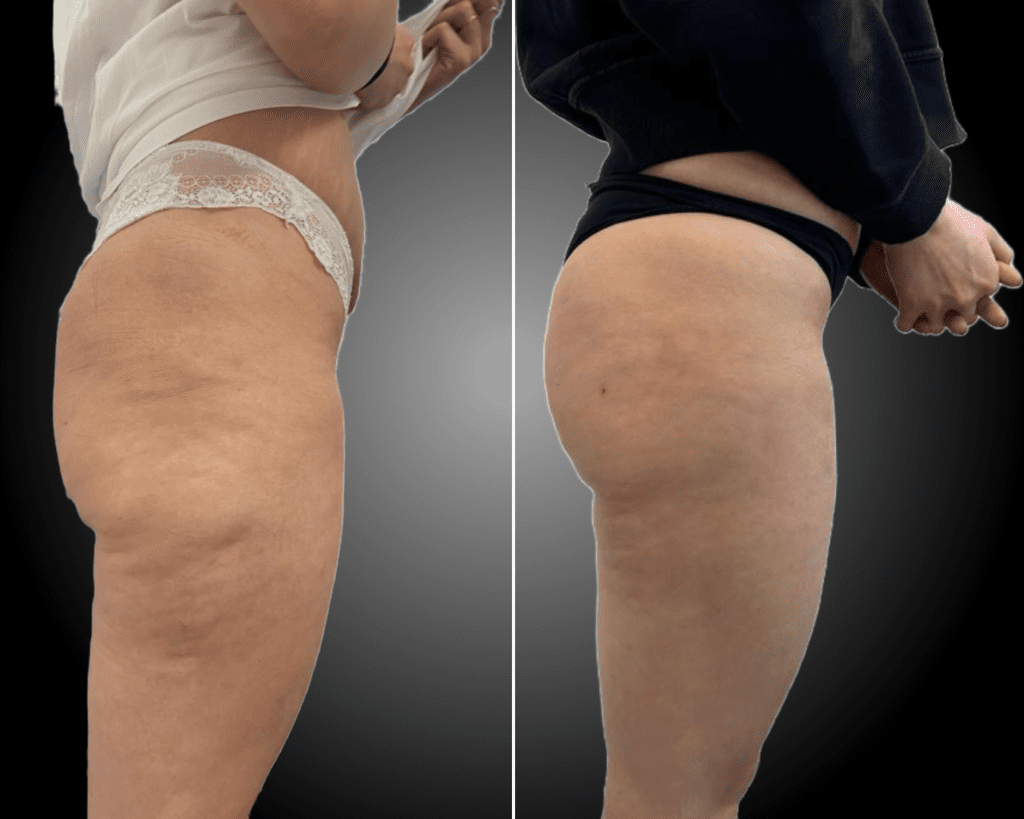 png_20230525_105001_0000