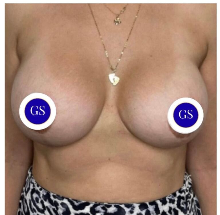 Collage-mastopessi-Napoli-1536x751 copia